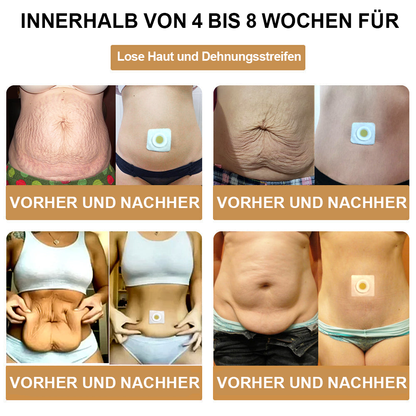 🐝 AFGAFG™💥💥 Bienen-Venom Lymphatischer Drainage Schlank-Patch【Empfohlen vom Arzt - Geeignet für Männer und Frauen】